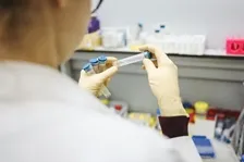 IMMUNOGLOBULIN M (IGM)