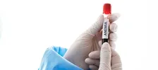 IRON DEFICIENCY PROFILE