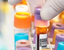 LIPASE
