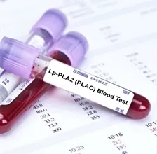 LP-PLA2
