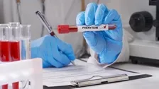 PHENYTOIN / DILANTIN / EPTOIN