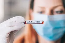 PROLACTIN (PRL)