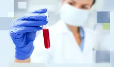 SERUM ZINC