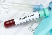 THYROID STIMULATING HORMONE (TSH)