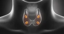 TOTAL THYROXINE (T4)