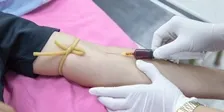 VDRL (RPR) FOR SYPHILIS