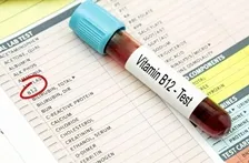 VITAMIN B-12