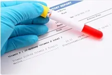 VITAMIN D PROFILE