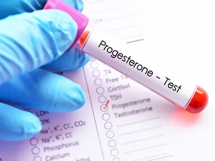 17 Oh Progesterone