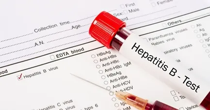 ANTI HEPATITIS B CORE ANTIGEN (AHBC) - IGM