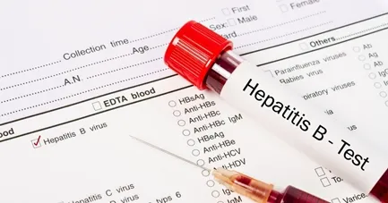 Anti Hepatitis B Core Antigen (AHBC) - Igm