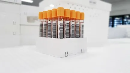 ANTI HEPATITIS B CORE ANTIGEN (AHBC) - TOTAL