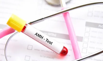 Anti Mullerian Hormone (AMH)