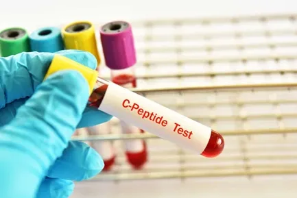 C PEPTIDE Test