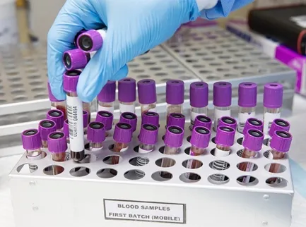 Cardiolipin Antibody (ACL) - Iga 