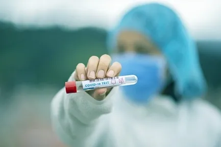 COVID ANTIBODY IGG (QUANTITATIVE) Test