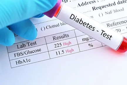 HbA1c Test Sample Report