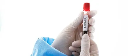 Iron Blood test