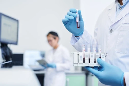 SMOKERS PANEL - BASIC available in vaishali health test