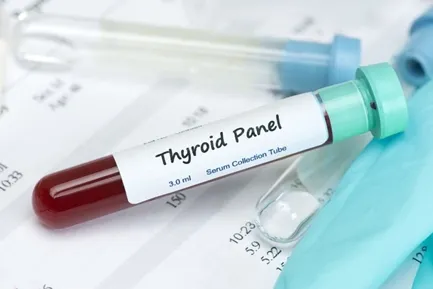 THYROID STIMULATING HORMONE (TSH)