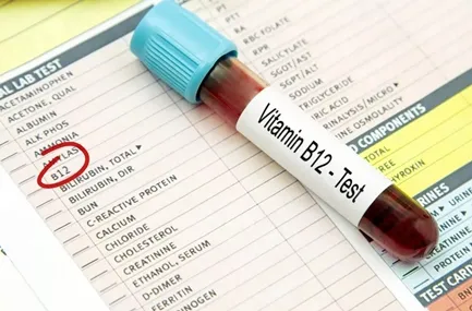 Vitamin B12 Sample Report